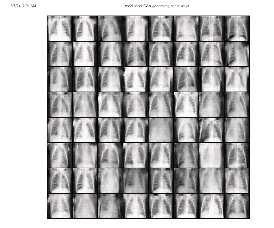 An image of the  DCGAN-and-cGAN-implementations-for-chest-xray project.